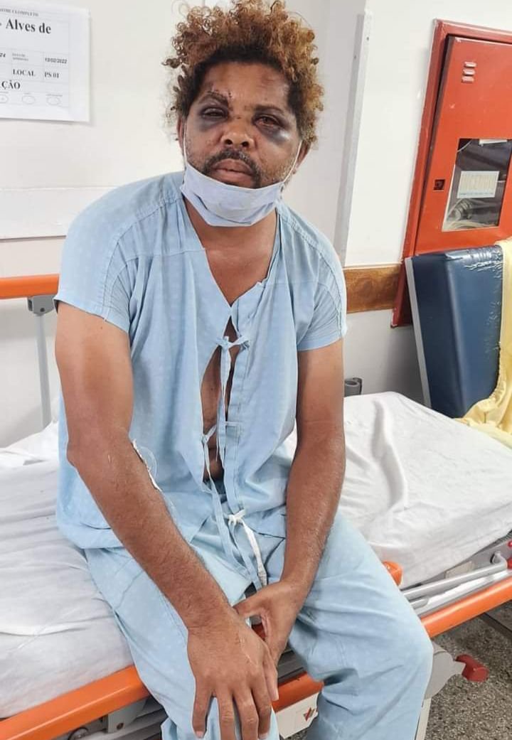 Morador de rua espancado por personal diz que mulher o chamou para ‘brincar’ dentro do carro