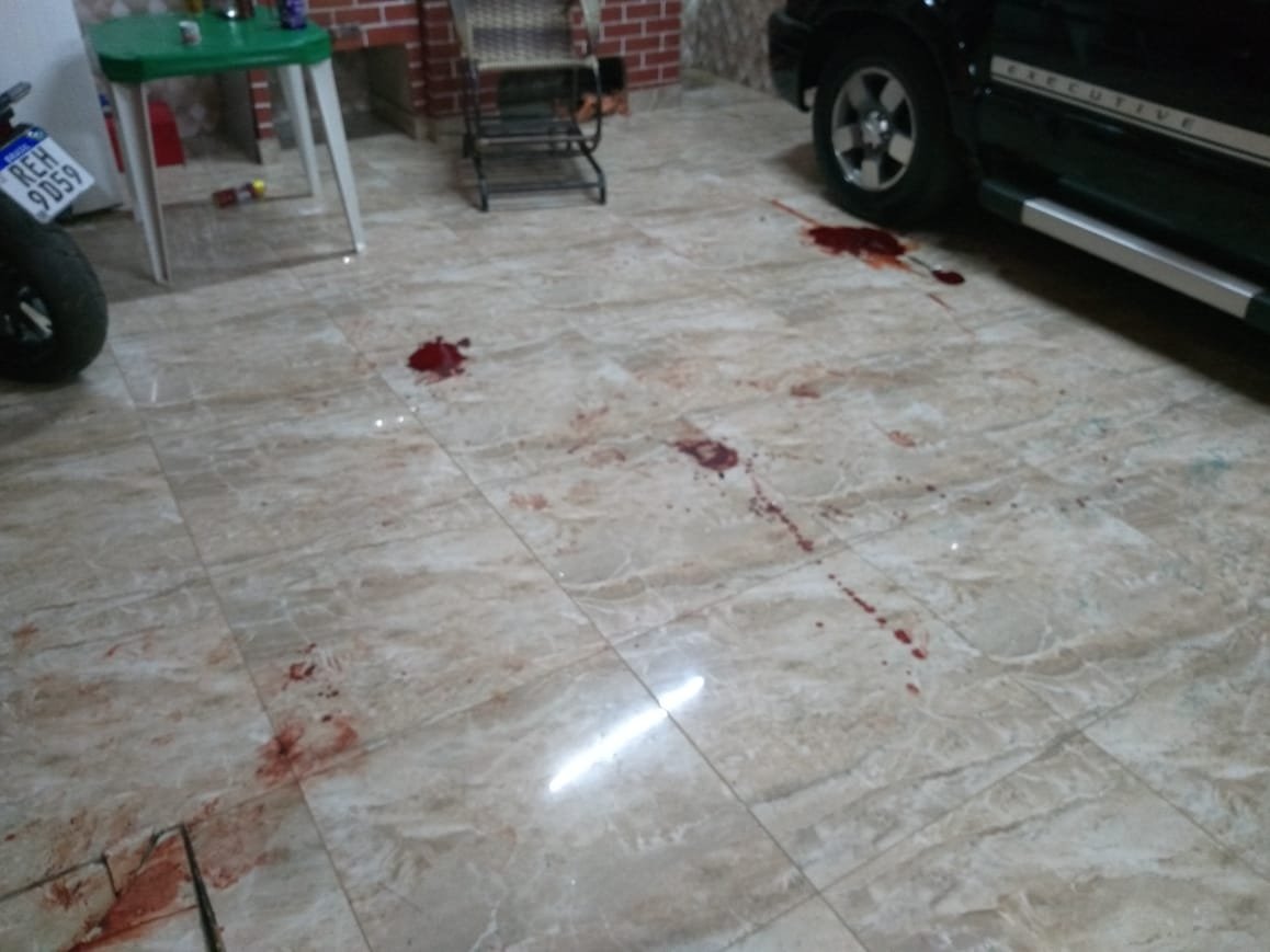 Acusado de matar companheira e tentar suicídio, recebe alta da UTI e continua em observação no hospital.