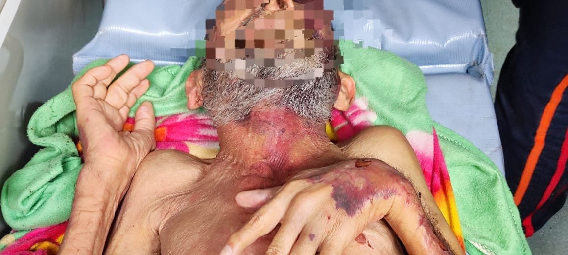 Idoso de 69 anos torturado por filho, é resgatado em situação deplorável durante operação policial em Valparaíso.