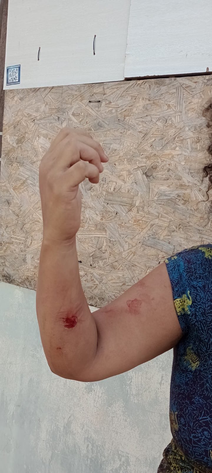 Vizinhos ouvem Gritos de socorro, chama polícia que impede feminicídio no J. Ingá.