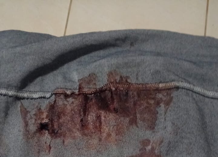 Mulher á caminho da igreja é baleada durante homicídio no céu azul, veja as fotos