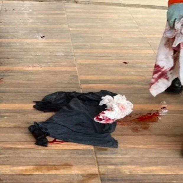 Mulher é presa após esfaquear companheiro durante briga em condomínio no Gama