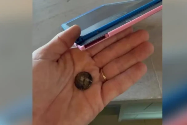 Bateria de brinquedo faz bebê de 1 ano ir parar no hospital com início de necrose em Goiânia