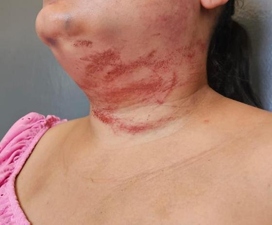 Homem mantém ex em cativeiro e usa corda para tenta matar enforcada