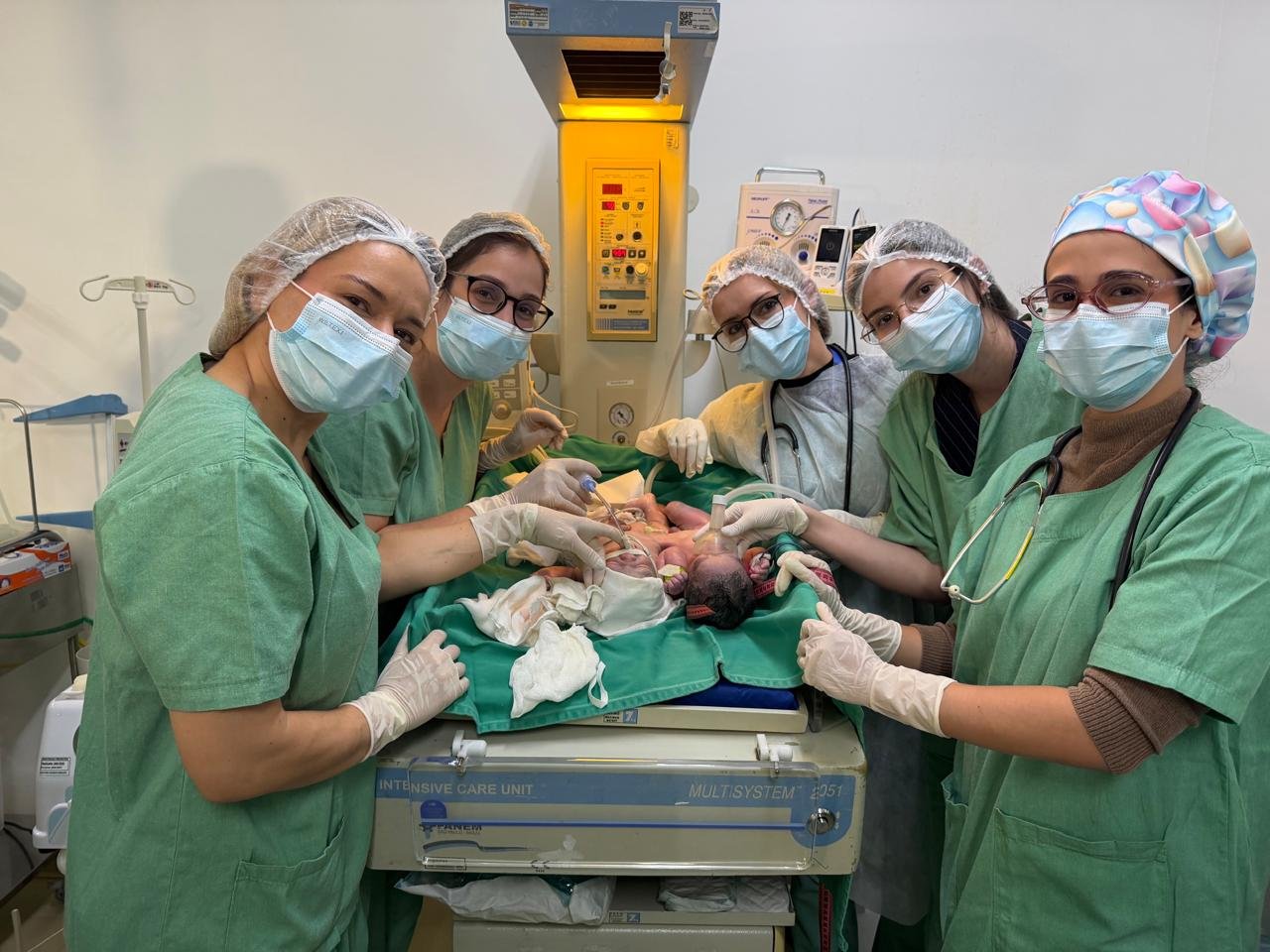 Siameses do Tocantins nascem em Goiânia e médicos apontam condições viáveis para separação