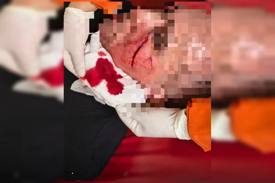 Veja ; Policial militar fica com rosto ferido durante atendimento de ocorrência no DF